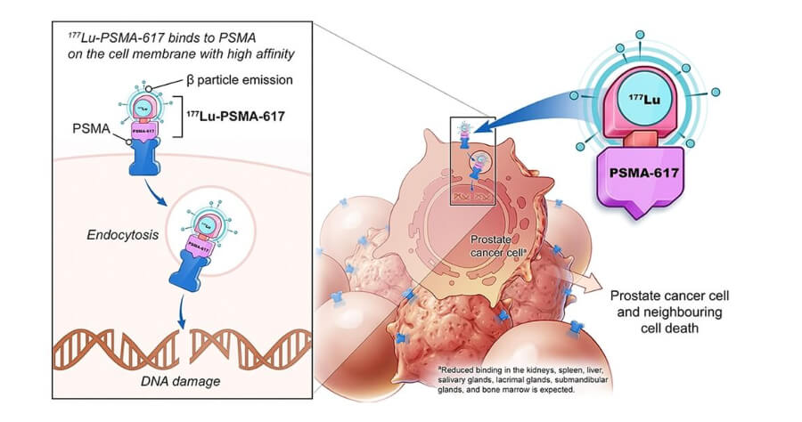 lutetium-177-psma-therapy-description